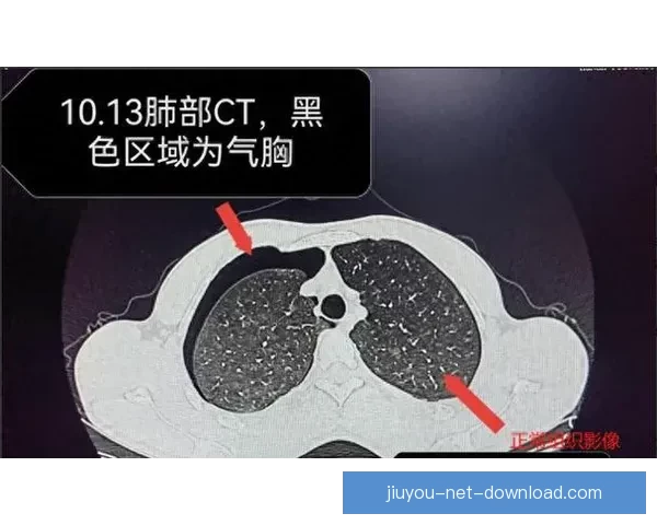 坎宁安气胸恢复顺利 活塞官方公布复查时间和复出计划